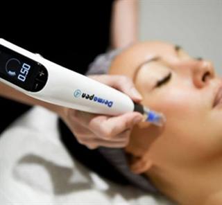 Microneedling with Dermapen 4