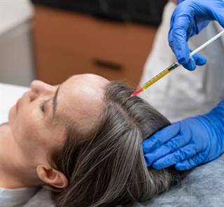 PRP hair fall treatment